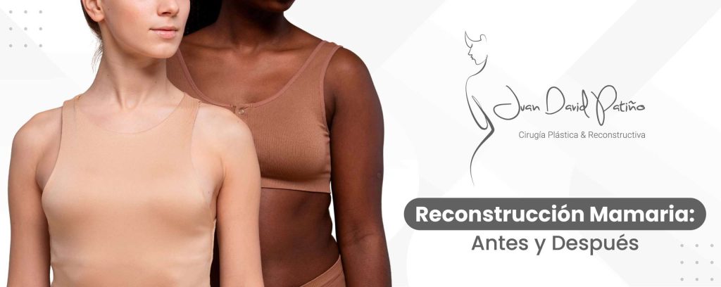 Reconstrucción Mamaria: Resultados Antes y Después - Dr. Juan David Patiño