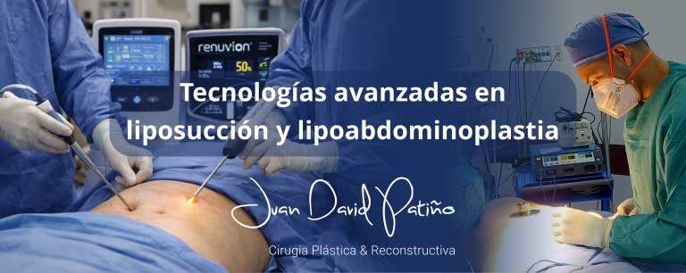 Tecnologías avanzadas para lipoabdominoplastia: Renuvion, plasma de argón y microaire – Dr. Juan David Patiño
