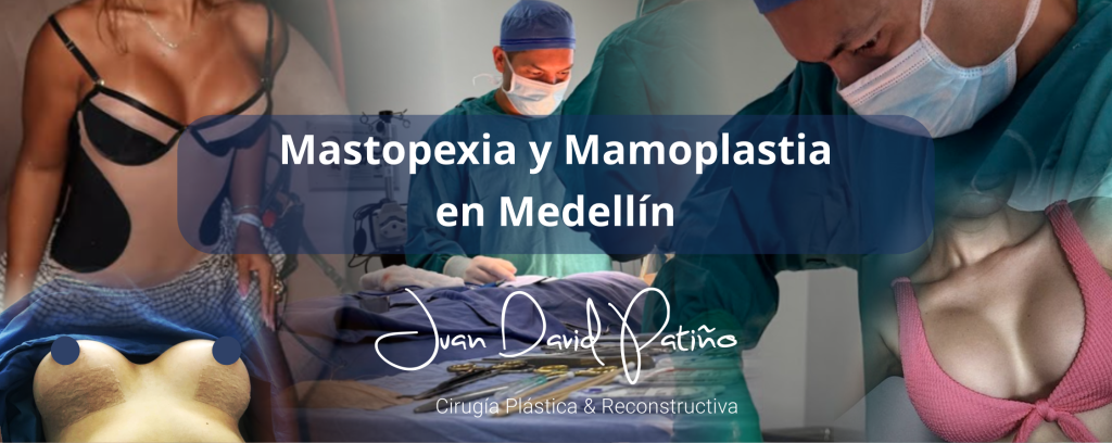 Especialista en mastopexia y mamoplastia de aumento en Medellín. Seguridad, experiencia y resultados armónicos y naturales.