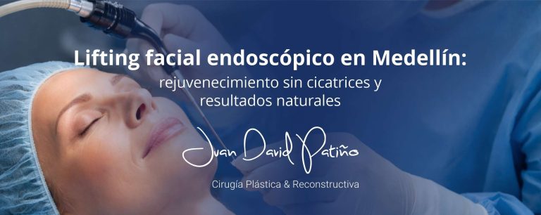 lifting facial endoscópico Medellín resultados naturales
