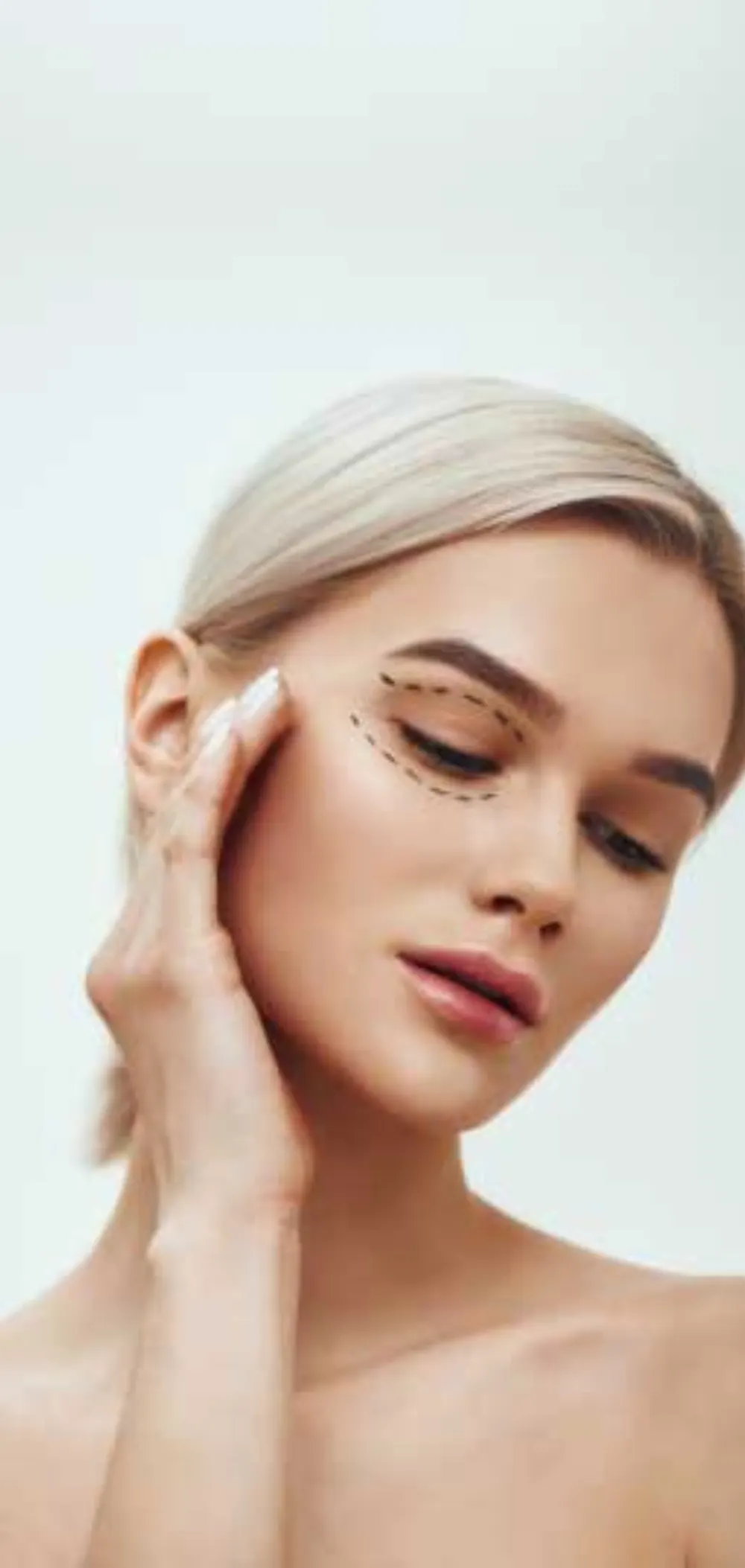 blefaroplastia en Medellín